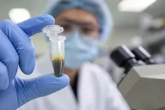 Detectan microplásticos en la bilis humana, vinculados al daño celular