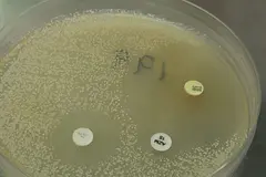 Investigación revela que bacteria del kimchi ayuda a eliminar nanoplásticos del organismo