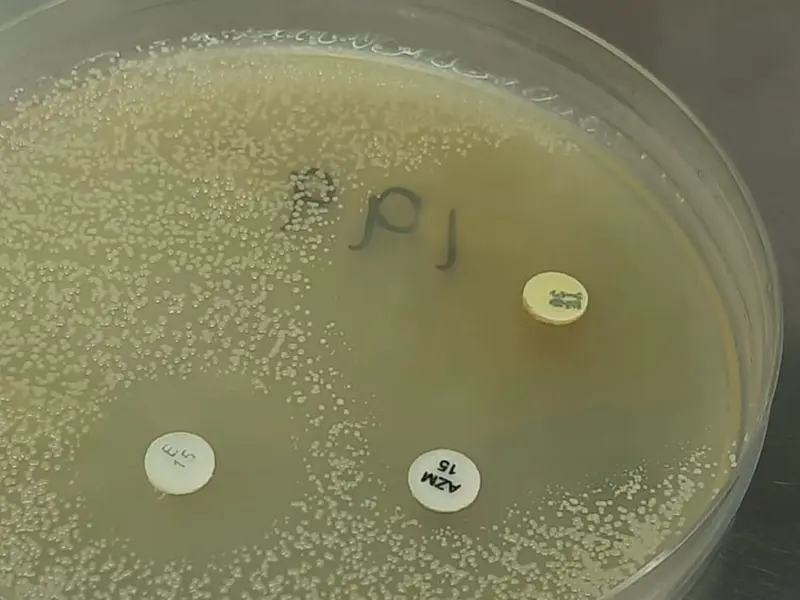 Investigación revela que bacteria del kimchi ayuda a eliminar nanoplásticos del organismo